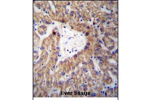 GLYAT Antibody (Center) (ABIN656988 and ABIN2846171) immunohistochemistry analysis in formalin fixed and paraffin embedded human liver tissue followed by peroxidase conjugation of the secondary antibody and DAB staining.