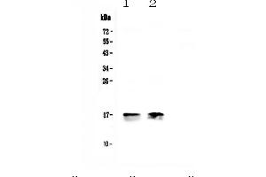 Western blot analysis of COX IV using anti-COX IV antibody .