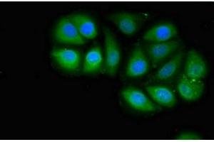 Immunofluorescent analysis of A549 cells using ABIN7159160 at dilution of 1:100 and Alexa Fluor 488-congugated AffiniPure Goat Anti-Rabbit IgG(H+L) (MED4 anticorps  (AA 167-270))