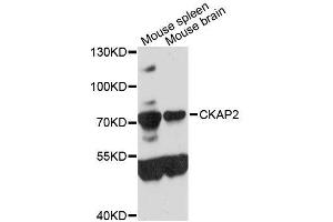 Western blot analysis of extracts of various cell lines, using CKAP2 antibody (ABIN5996642) at 1:3000 dilution.