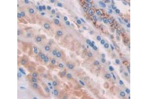 IHC-P analysis of Human Tissue, with DAB staining. (HYAL1 anticorps  (AA 22-435))