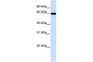 Leiomodin 1 antibody used at 1 ug/ml to detect target protein. (Leiomodin 1 anticorps)