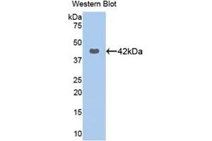Western blot analysis of the recombinant protein. (KRT16 anticorps  (AA 117-419))
