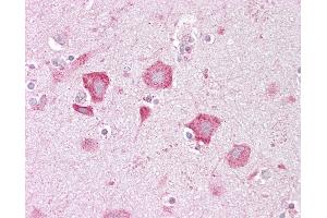 Anti-KCNQ2 antibody IHC of human brain, cortex.