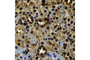 Immunohistochemical analysis of Myosin Ic staining in rat kidney formalin fixed paraffin embedded tissue section.