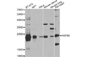Western blot analysis of extracts of various cell lines, using HSPB8 antibody (ABIN5971347) at 1/1000 dilution. (HSPB8 anticorps)