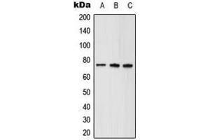 Western blot analysis of ABCD1 expression in HeLa (A), mouse brain (B), rat kidney (C) whole cell lysates. (ABCD1 anticorps  (Center))