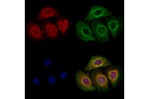 ABIN6257891 and ABIN6273815 staining Hela cells by IF/ICC. (TRIO anticorps  (Internal Region))