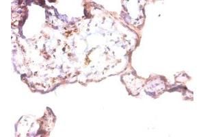 Immunohistochemistry of paraffin-embedded human placenta tissue using ABIN7144088 at dilution of 1:50