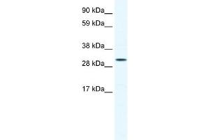 WB Suggested Anti-SOX12 Antibody Titration: 0.