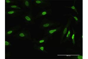 Immunofluorescence of purified MaxPab antibody to MSH2 on HeLa cell.