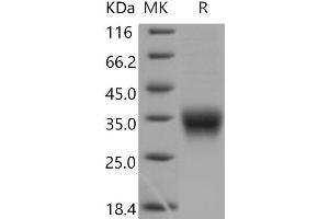 Western Blotting (WB) image for CD8a Molecule (CD8A) (Active) protein (His tag) (ABIN7320295)