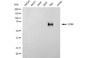 Western blotting analysis using CD86 antibody (ABIN7797985).