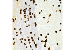 Immunohistochemistry of paraffin-embedded Rat brain using DiMethyl-Histone H3-K27 antibody.