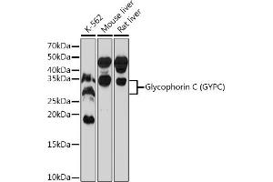 Western blot analysis of extracts of various cell lines, using Glycophorin C (GYPC) (GYPC) Rabbit mAb (ABIN7267476) at 1:1000 dilution. (CD236/GYPC anticorps)