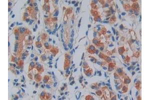 IHC-P analysis of Human Stomach Tissue, with DAB staining. (IRAK2 anticorps  (AA 235-521))