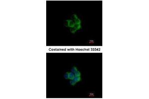 ICC/IF Image Immunofluorescence analysis of methanol-fixed A431, using NDUFA10, antibody at 1:200 dilution.