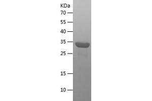 Western Blotting (WB) image for Interleukin 16 (IL16) (AA 1212-1332) protein (His-IF2DI Tag) (ABIN7123551) (IL16 Protein (AA 1212-1332) (His-IF2DI Tag))
