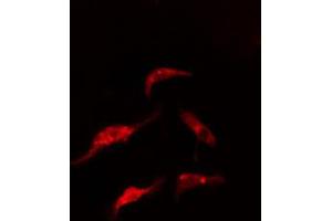 ABIN6274864 staining HeLa cells by IF/ICC. (ARMC6 anticorps  (C-Term))