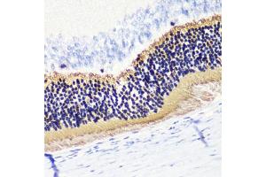 Immunohistochemistry of paraffin-embedded rat retina using PDC antibody (ABIN6132871, ABIN6145332, ABIN6145333 and ABIN6224509) at dilution of 1:200 (40x lens). (Phosducin anticorps  (AA 1-246))