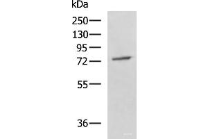 Western blot analysis of A549 cell lysate using GPCPD1 Polyclonal Antibody at dilution of 1:800 (GPCPD1 anticorps)