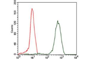 Immunohistochemical analysis of paraffin-embedded colon cancer tissues using EIF4B antibody with DAB staining. (EIF4B anticorps)