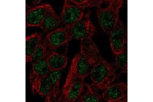 Immunofluorescent staining of HepG2 with SLC5A11 polyclonal antibody  (Green) shows localization to nucleoplasm. (Solute Carrier Family 5 (Sodium/inositol Cotransporter), Member 11 (SLC5A11) anticorps)