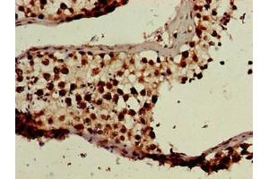 Immunohistochemistry of paraffin-embedded human testis tissue using ABIN7145258 at dilution of 1:100