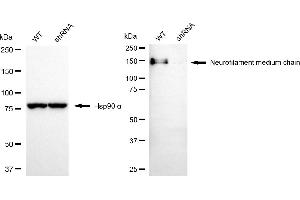 Western blotting analysis using neurofilament medium chain antibody (ABIN7799580). (NEFM anticorps)