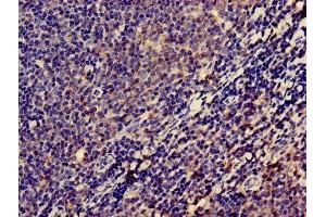 Immunohistochemistry of paraffin-embedded human lymph node tissue using ABIN7158308 at dilution of 1:100 (Leupaxin anticorps  (AA 1-300))