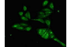 anti-Forkhead Box I1 (FOXI1) (AA 183-343) antibody