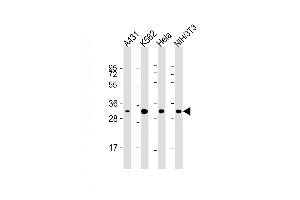 All lanes : Anti-CDK5 Antibody at 1:2000 dilution Lane 1: A431 whole cell lysate Lane 2: K562 whole cell lysate Lane 3: Hela whole cell lysate Lane 4: NIH/3T3 whole cell lysate Lysates/proteins at 20 μg per lane. (CDK5 anticorps)