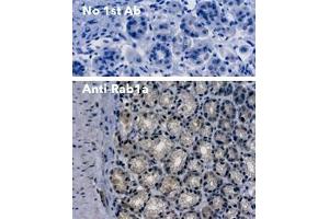 Immunohistochemistry (IHC) image for anti-RAB1A, Member RAS Oncogene Family (RAB1A) (C-Term) antibody (ABIN7272978)