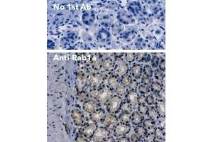 Immunohistochemistry (IHC) image for anti-RAB1A, Member RAS Oncogene Family (RAB1A) (C-Term) antibody (ABIN7272978) (RAB1A anticorps  (C-Term))