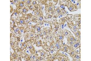 Immunohistochemistry of paraffin-embedded Human liver using GATM Polyclonal Antibody at dilution of 1:100 (40x lens). (GATM anticorps)