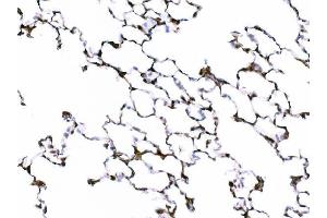 anti-Galectin 3 (LGALS3) (AA 153-264) antibody