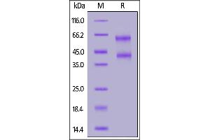 Human IL-2RB&IL-2RG Heterodimer Protein, His Tag&T Tag on  under reducing (R) condition. (IL-2 R beta & IL-2 R gamma (AA 27-239) (Active) protein (His tag,Strep Tag))