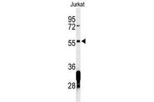 Western blot analysis of RNF8 Antibody in Jurkat cell line lysates (35µg/lane). (RNF8 anticorps)