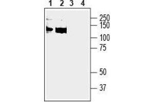 Western blot analysis of human  monocytic leukemia cell line lysate (lanes 1 and 3) and human  megakaryoblastic leukemia cell line lysate (lanes 2 and 4):1,2. (Anoctamin 6 (ANO6) Peptide)