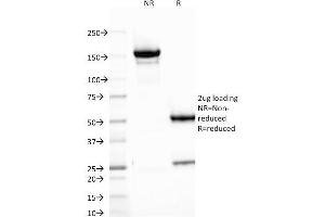 SDS-PAGE Analysis Purified B7-H4 Mouse Monoclonal Antibody (B7H4/1788). (VTCN1 anticorps)