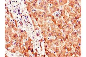 Immunohistochemistry of paraffin-embedded human liver tissue using ABIN7169898 at dilution of 1:100 (SMO anticorps  (AA 28-233))