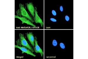 (ABIN185658) Immunofluorescence analysis of paraformaldehyde fixed HeLa cells, permeabilized with 0. (GRIN2B anticorps  (Internal Region))