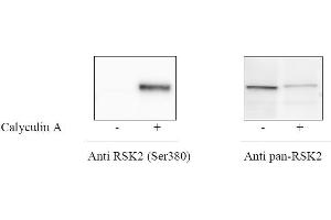 HeLa cells were treated or untreated with Calyculin A.