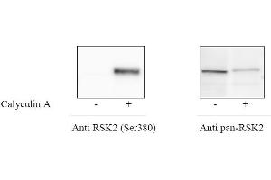 HeLa cells were treated or untreated with Calyculin A. (ATF2 Kit ELISA)