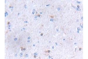 Detection of GLTP in Human Cerebrum Tissue using Polyclonal Antibody to Glycolipid Transfer Protein (GLTP) (GLTP anticorps  (AA 2-209))