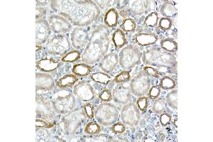 Immunohistochemistry of paraffin-embedded rat kidney using DC Rabbit mAb (ABIN7266685) at dilution of 1:200 (40x lens). (DCAF7 anticorps)