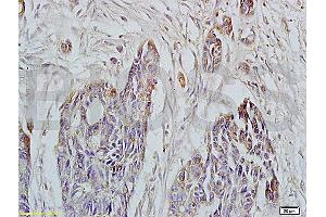 Immunohistochemistry (IHC) image for anti-HLA Class I Histocompatibility Antigen, alpha Chain E (HLA-E) (AA 251-358) antibody (ABIN674334)