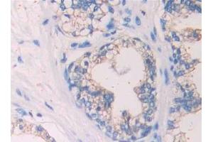 Detection of SIGIRR in Human Prostate Tissue using Polyclonal Antibody to Single Ig IL1 Related Receptor (SIGIRR)