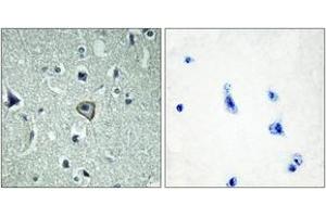 Immunohistochemistry analysis of paraffin-embedded human brain tissue, using BAI2 Antibody. (BAI2 anticorps  (AA 91-140))