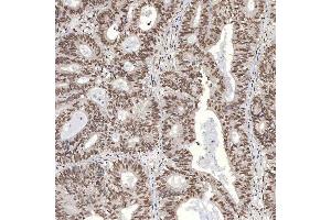 IHC analysis of U1A/SNRPA using anti-U1A/SNRPA antibody (ABIN7600891). (SNRPA1 anticorps  (AA 25-218))